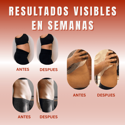 GOMINOLAS DE VINAGRE DE MANZANA - CUIDA TU SALUD